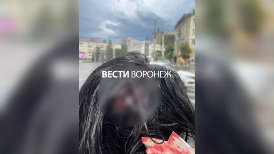 10 июля кусок лепнины с дома №52 на Кольцовской улице попал в голову проходившей мимо девушке — у неё сотрясение мозга. Пострадавшая собирается добиваться компенсации через суд, управляющая компания пока молчит. Случай стал очередным в ряду падений строительных фрагментов в центре города.