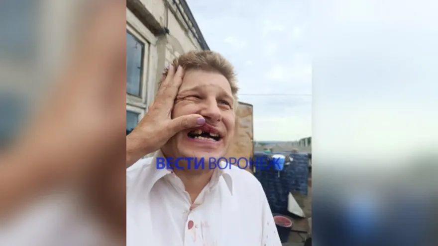 8 июля рано утром в районе улицы Хользунова мужчина с инвалидностью подвергся нападению и получил многочисленные травмы; прокуратура и полиция проводят проверку и розыск подозреваемого.